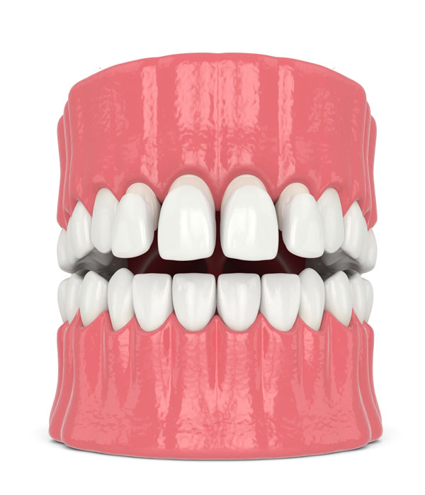 Beneficis de l'estètica dental