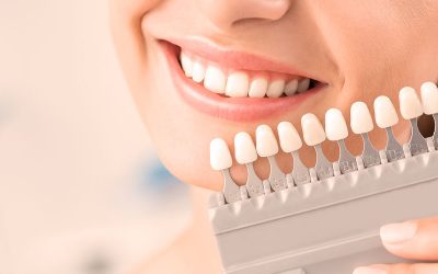 Implante dental inmediato vs tradicional