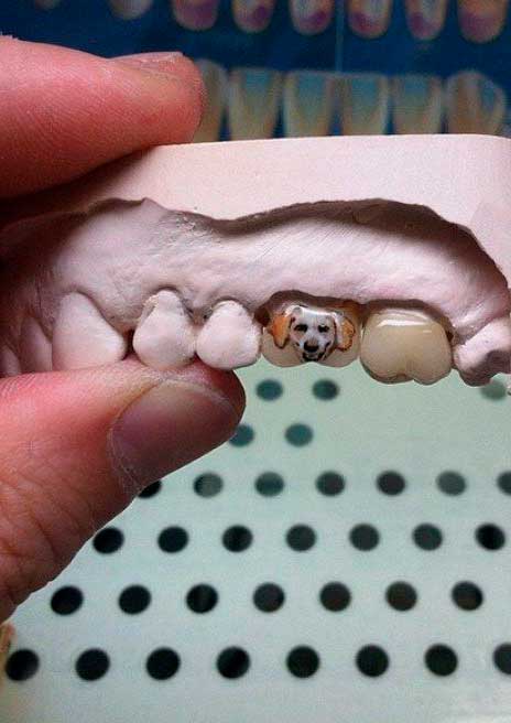 modas dentales que perjudican los dientes